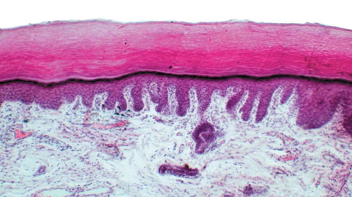 Injured Skin Cells Fire like Neurons to ‘Scream’ for Help